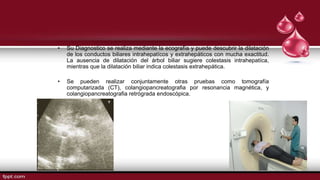 • Su Diagnostico se realiza mediante la ecografía y puede descubrir la dilatación
de los conductos biliares intrahepatícos y extrahepáticos con mucha exactitud.
La ausencia de dilatación del árbol biliar sugiere colestasis intrahepatíca,
mientras que la dilatación biliar indica colestasis extrahepática.
• Se pueden realizar conjuntamente otras pruebas como tomografía
computarizada (CT), colangiopancreatografia por resonancia magnética, y
colangiopancreatografia retrógrada endoscópica.
 