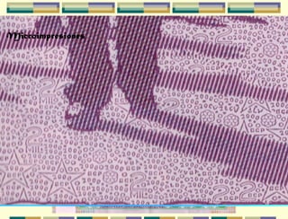 Ventana Compleja
Grabado Transitorio
Elemento Óptico DinámicoMarca de Agua o
imagen Sombreada
Registro PerfectoImpresiones Transparentes
Sensibles al Tacto
Impresiones Transparentes
Sensibles al TactoImpresiones Off-SetImpresiones
Calcograficas
Impresión Tipografica
sensible a U.V
MicroimpresionesMicroimpresionesMicroimpresiones
 