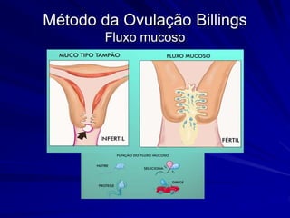 Método da Ovulação Billings
Fluxo mucoso
 