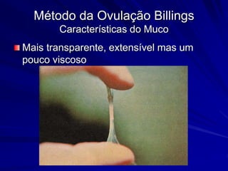 Método da Ovulação Billings
Características do Muco
Mais transparente, extensível mas um
pouco viscoso
 