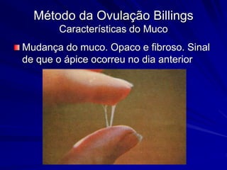 Método da Ovulação Billings
Características do Muco
Mudança do muco. Opaco e fibroso. Sinal
de que o ápice ocorreu no dia anterior
 