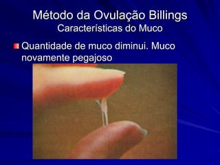 Método da Ovulação Billings
Características do Muco
Quantidade de muco diminui. Muco
novamente pegajoso
 