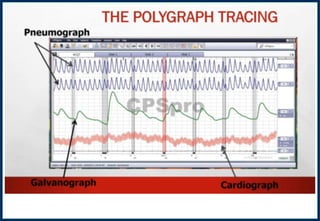 Article 203Article 203Article 203Article 203