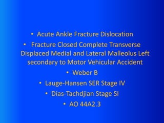 • Acute Ankle Fracture Dislocation
• Fracture Closed Complete Transverse
Displaced Medial and Lateral Malleolus Left
secondary to Motor Vehicular Accident
• Weber B
• Lauge-Hansen SER Stage IV
• Dias-Tachdjian Stage SI
• AO 44A2.3
 