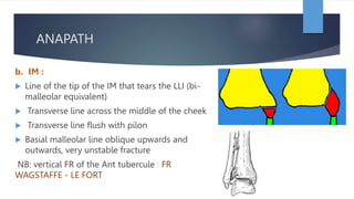 BIMALLEOLAR FRACTURES mechanism and anapath.pptx