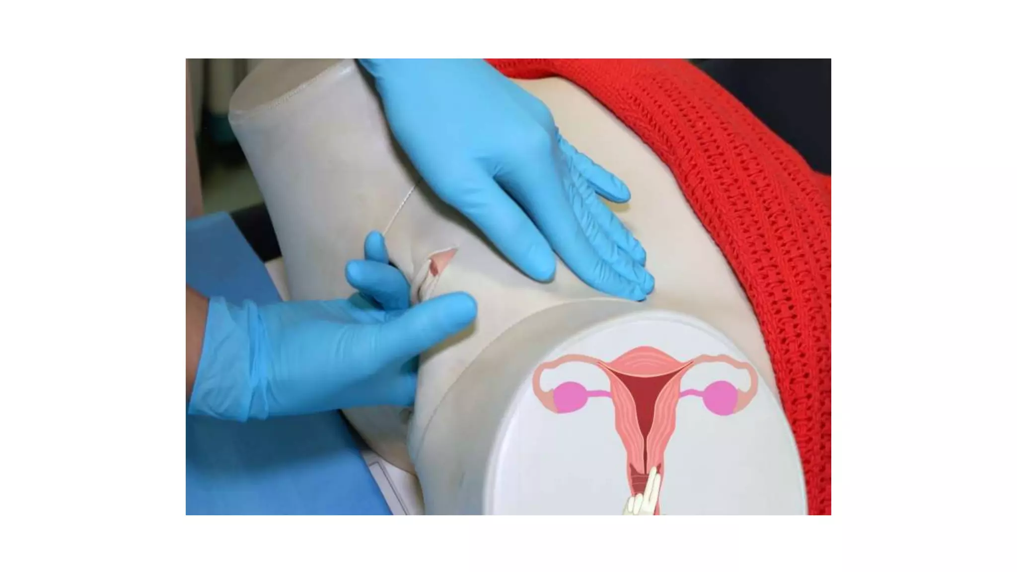 Bimanual examination.pptx