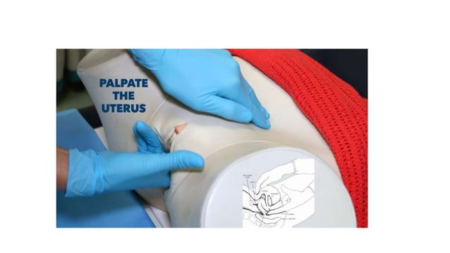 Bimanual examination.pptx