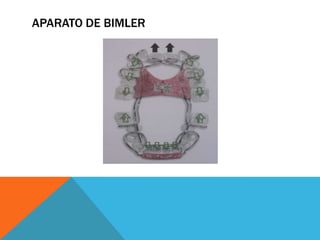 APARATO DE BIMLER<br />