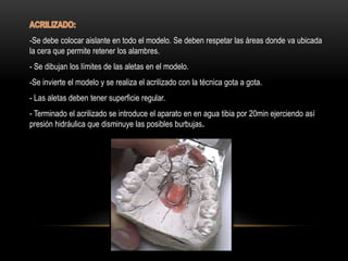 -Se debe colocar aislante en todo el modelo. Se deben respetar las áreas donde va ubicada
la cera que permite retener los alambres.
- Se dibujan los límites de las aletas en el modelo.
-Se invierte el modelo y se realiza el acrilizado con la técnica gota a gota.
- Las aletas deben tener superficie regular.
- Terminado el acrilizado se introduce el aparato en en agua tibia por 20min ejerciendo así
presión hidráulica que disminuye las posibles burbujas.
 