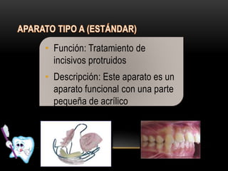 • Función: Tratamiento de
incisivos protruidos
• Descripción: Este aparato es un
aparato funcional con una parte
pequeña de acrílico
 