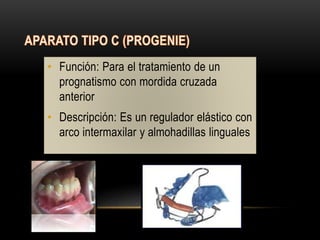 • Función: Para el tratamiento de un
prognatismo con mordida cruzada
anterior
• Descripción: Es un regulador elástico con
arco intermaxilar y almohadillas linguales
 