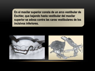 En el maxilar superior consta de un arco vestibular de
Eschler, que bajando hasta vestibular del maxilar
superior se adosa contra las caras vestibulares de los
incisivos inferiores.
 