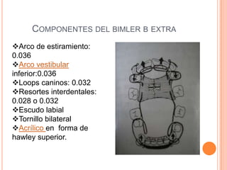 COMPONENTES DEL BIMLER B EXTRA
Arco de estiramiento:
0.036
Arco vestibular
inferior:0.036
Loops caninos: 0.032
Resortes interdentales:
0.028 o 0.032
Escudo labial
Tornillo bilateral
Acrílico en forma de
hawley superior.

 