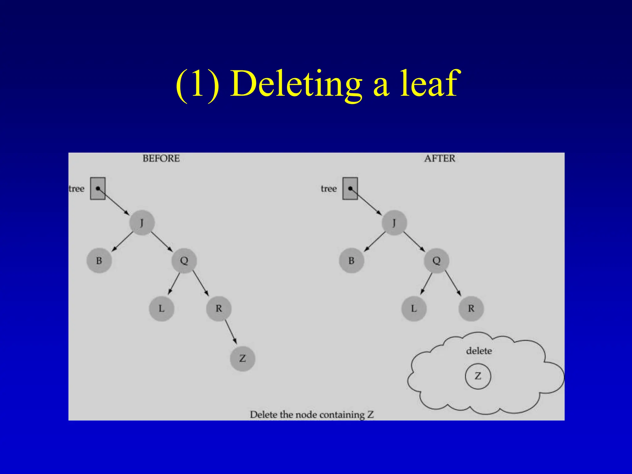 (1) Deleting a leaf 