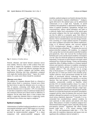 Pain management in total knee replacement | PDF