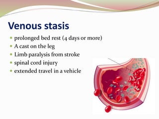 Venous stasis
 prolonged bed rest (4 days or more)
 A cast on the leg
 Limb paralysis from stroke
 spinal cord injury
 extended travel in a vehicle
 