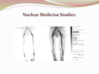 Nuclear Medicine Studies
 