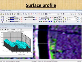 Surface profile
 