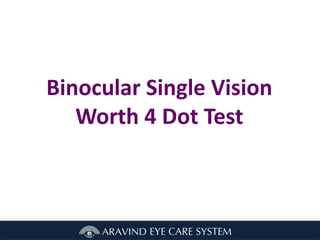 Binocular Single Vision
Worth 4 Dot Test
 