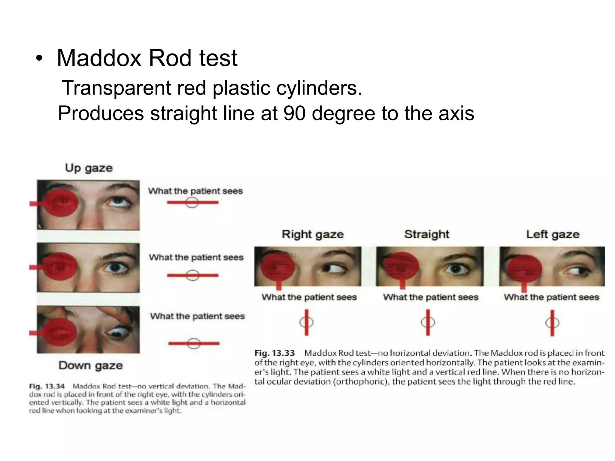 • Maddox Rod test
 Transparent red plastic cylinders.
 Produces straight line at 90 degree to the axis
 