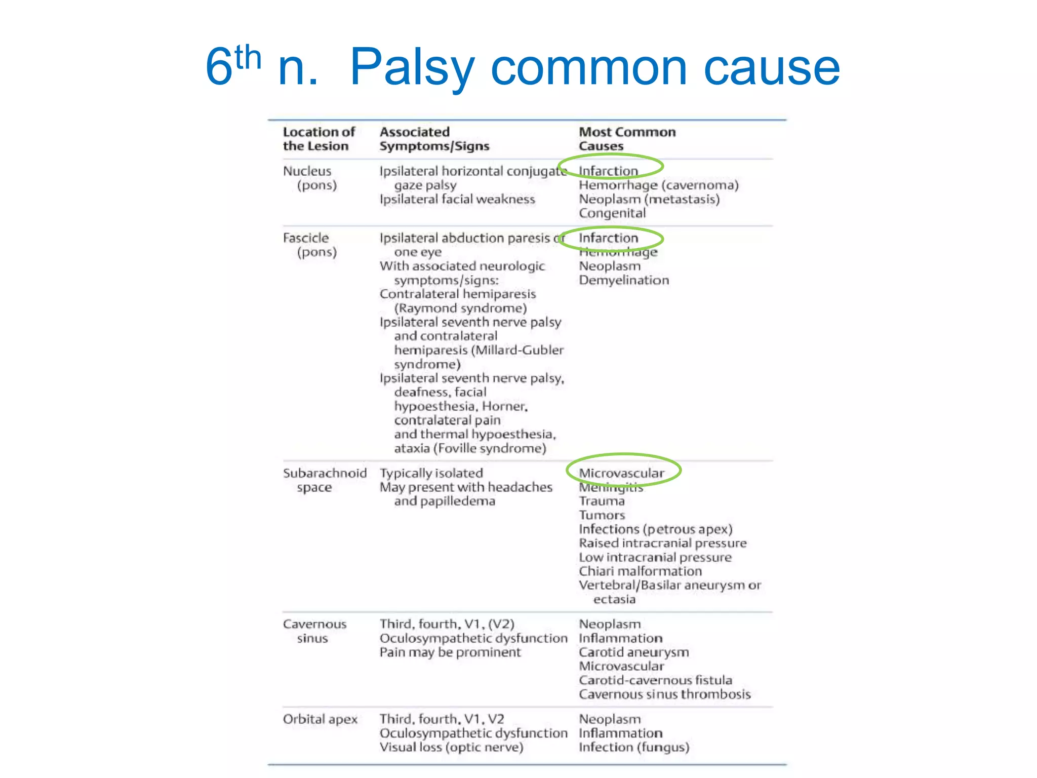 6th n. Palsy common cause
 