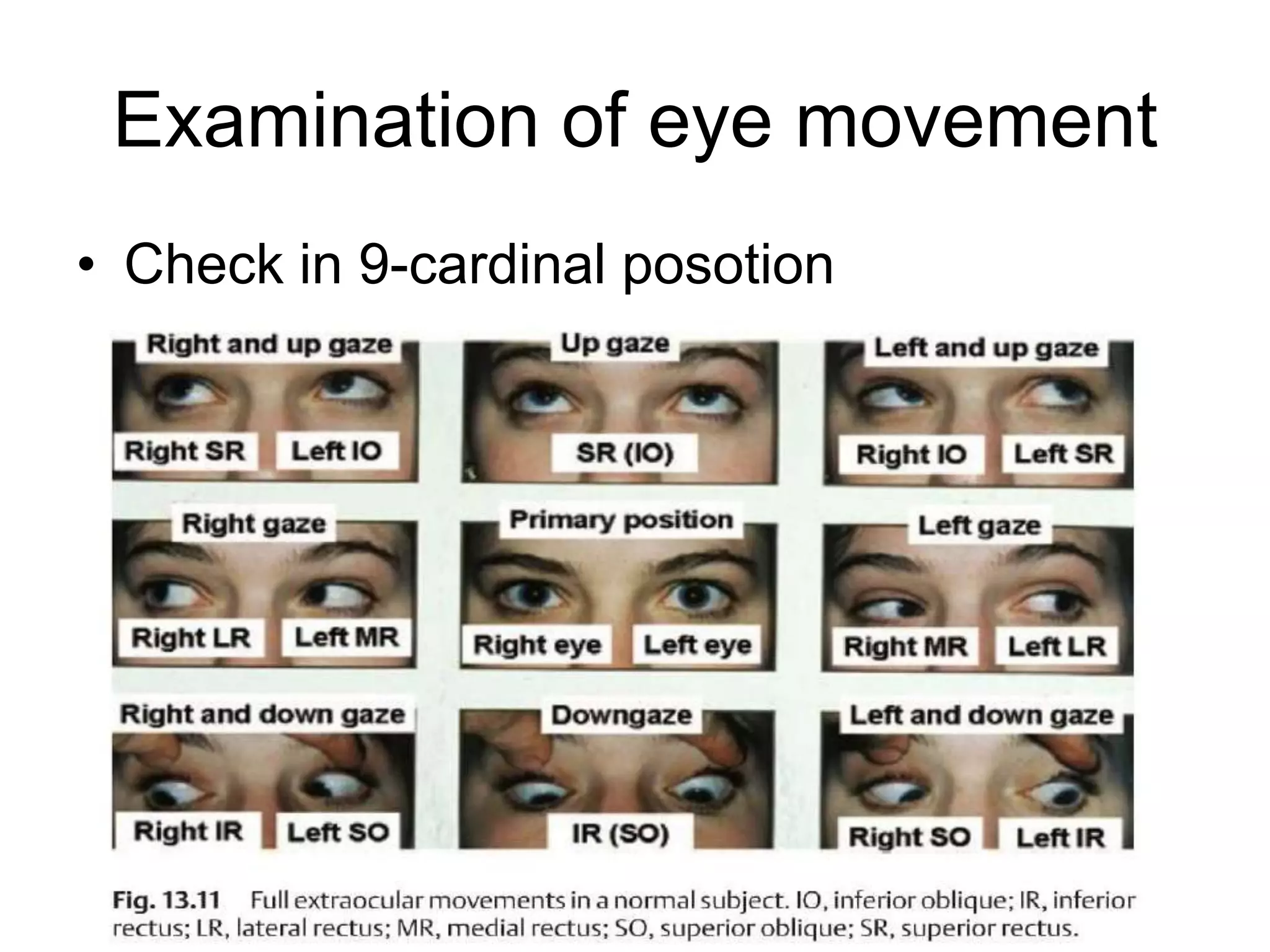 Examination of eye movement
• Check in 9-cardinal posotion
 