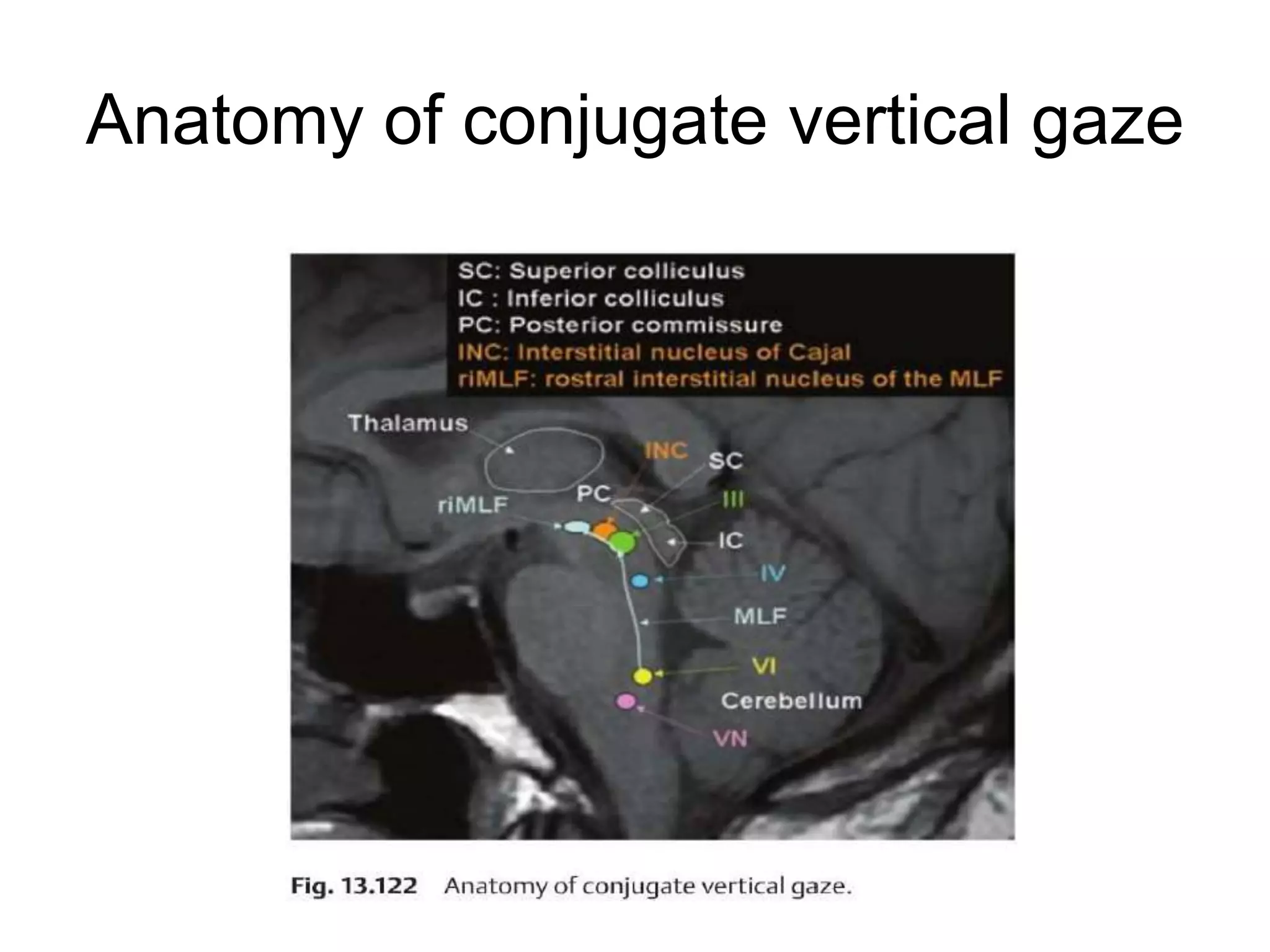 Anatomy of conjugate vertical gaze
 
