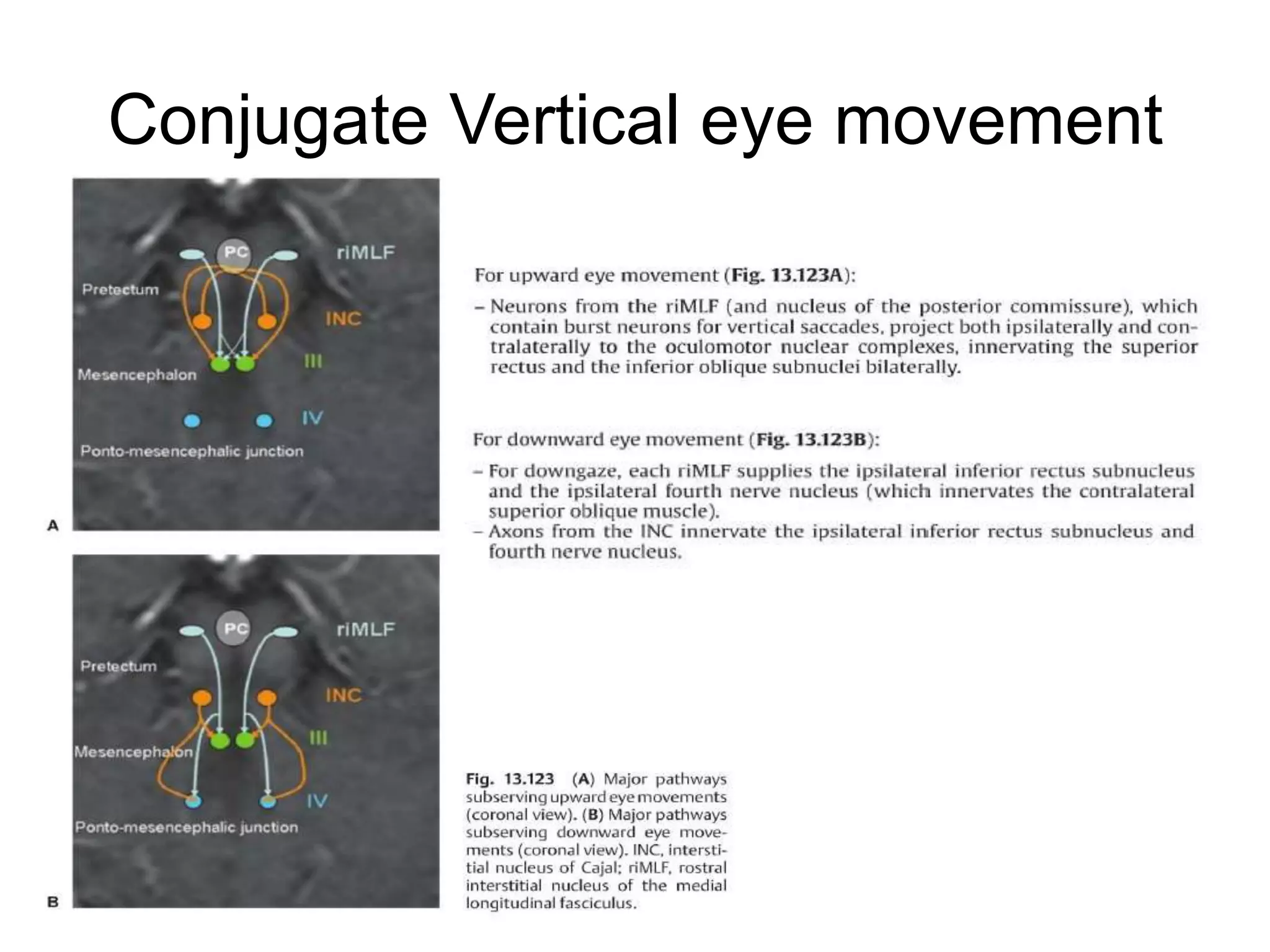 Conjugate Vertical eye movement
 