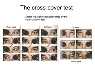The cross-cover test
  Latent misalignment not revealed by the
  cover-uncover test
 