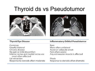 Thyroid ds vs Pseudotumor
 