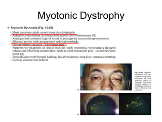 Myotonic Dystrophy
 