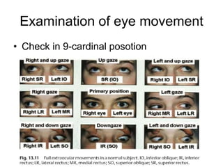 Examination of eye movement
• Check in 9-cardinal posotion
 
