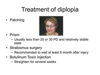 Treatment of diplopia
• Patching


• Prism
   – Usually less than 20 or 30 PD and relatively stable
     state
• Strabismus surgery
   – Recommended to wait at least 6 month after injery
• Botulinum Toxin injection
   – Straighten for several weeks
 