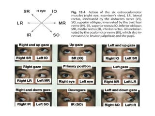 binocular diplopia