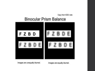 Binocular refraction techniques, binocular balancing & binocular | PPTX