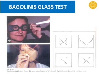 BAGOLINIS GLASS TEST
 