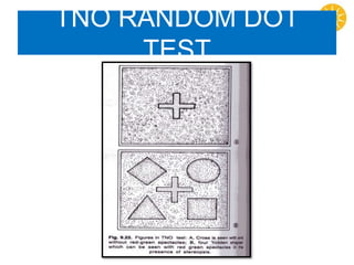 TNO RANDOM DOT
TEST
 