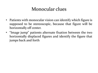 Monocular clues
• Patients with monocular vision can identify which figure is
supposed to be stereoscopic, because that figure will be
horizontally off center.
• “Image jump” patients alternate fixation between the two
horizontally displaced figures and identify the figure that
jumps back and forth
 