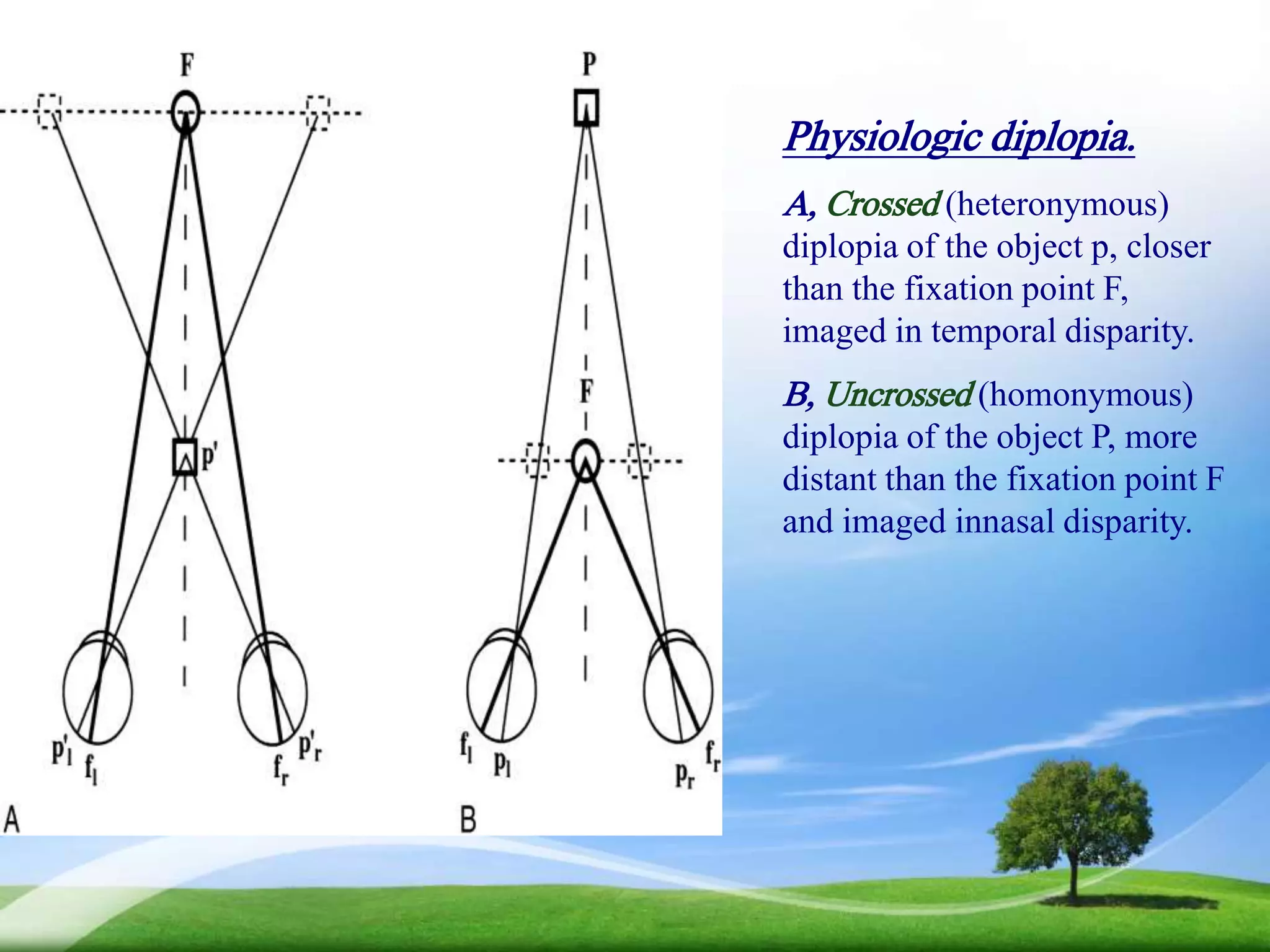 Binocular vision and vision perception | PPTX