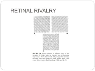 RETINAL RIVALRY
 