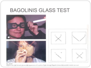 BAGOLINIS GLASS TEST
 