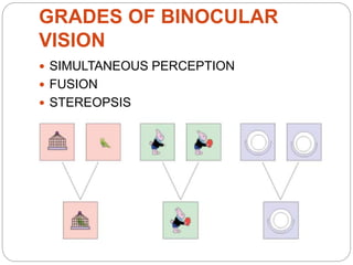 GRADES OF BINOCULAR
VISION
 SIMULTANEOUS PERCEPTION
 FUSION
 STEREOPSIS
 
