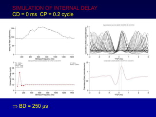 SIMULATION OF INTERNAL DELAY
CD = 0 ms CP = 0.2 cycle
? BD = 250 ms
 