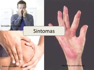 Sensação de cansaço

                      Sintomas




 Dores musculares                Manchas avermelhadas
 