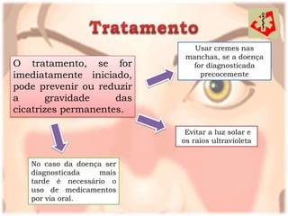 Usar cremes nas
                            manchas, se a doença
O tratamento, se for         for diagnosticada
imediatamente iniciado,        precocemente
pode prevenir ou reduzir
a      gravidade     das
cicatrizes permanentes.

                            Evitar a luz solar e
                           os raios ultravioleta


   No caso da doença ser
   diagnosticada   mais
   tarde é necessário o
   uso de medicamentos
   por via oral.
 
