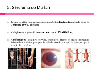 2. Síndrome de Marfan 
 Doença genética com transmissão autossômica dominante, afetando cerca de 
1 em cada 10.000 pessoas; 
 Mutação de um gene situado no cromossomo 15, a fibrilina; 
 Manifestações: estatura elevada, escoliose, braços e mãos alongadas, 
deformidade torácica, prolapso de válvula mitral, dilatação da aorta, miopia e 
luxação do cristalino. 
 
