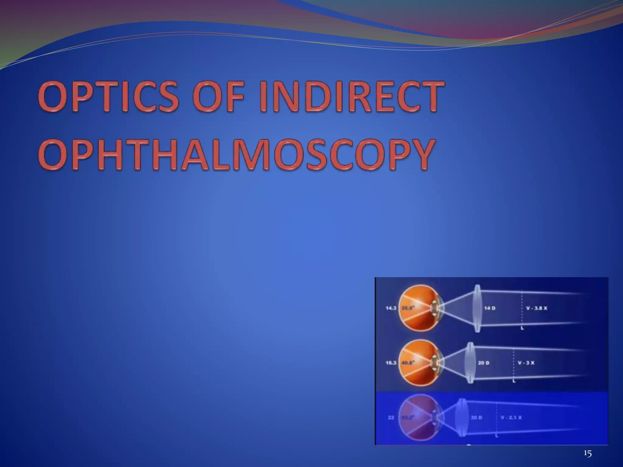 Binocular Indirect OPHTHALMOSCOPY PPT