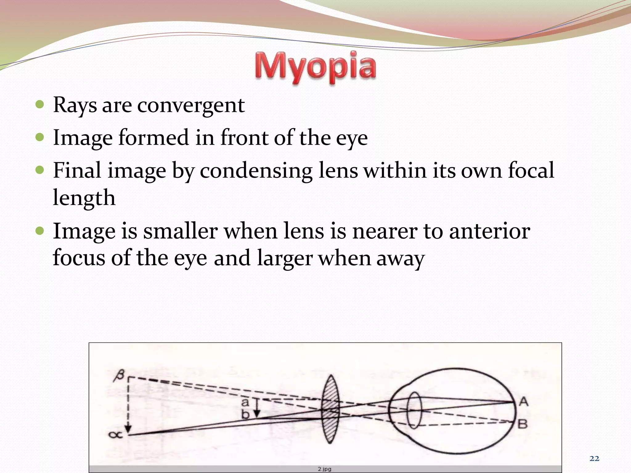 Binocular Indirect OPHTHALMOSCOPY PPT