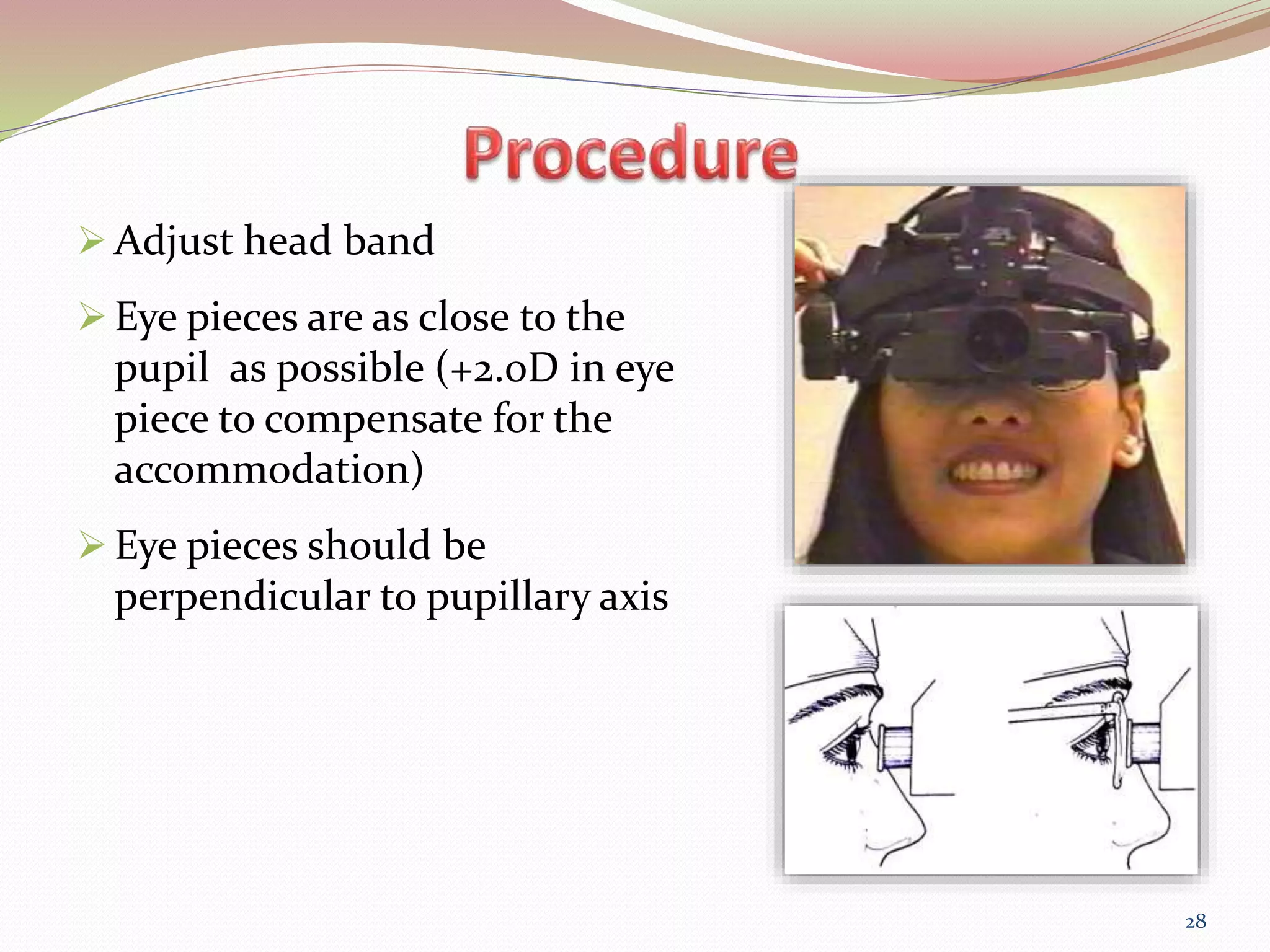 Binocular Indirect OPHTHALMOSCOPY PPT