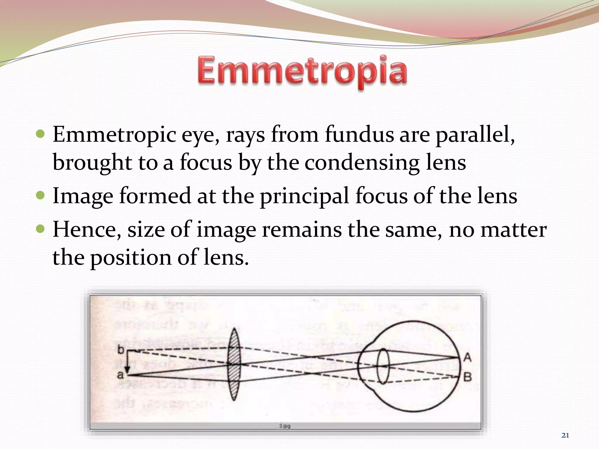 Binocular Indirect OPHTHALMOSCOPY